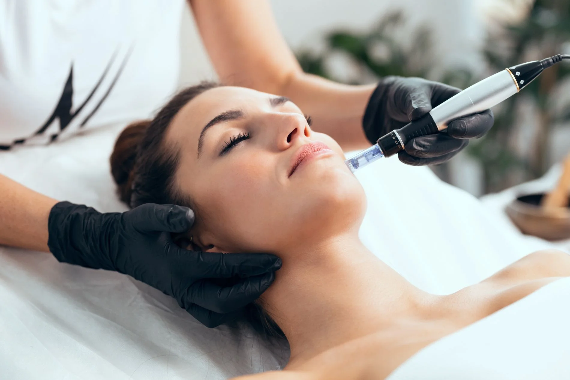 Advanced Microneedling in Allen TX