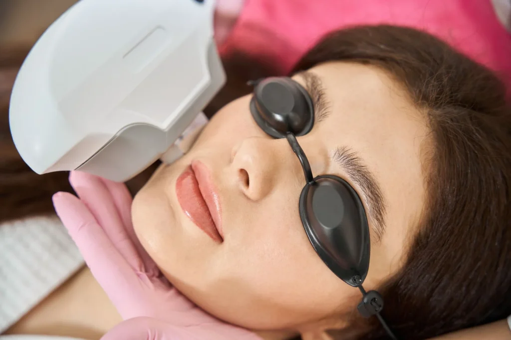 IPL Photofacial in Allen TX