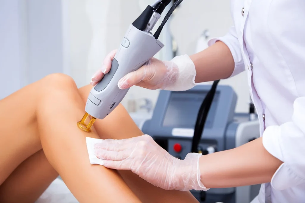 Laser Hair Removal in Allen TX